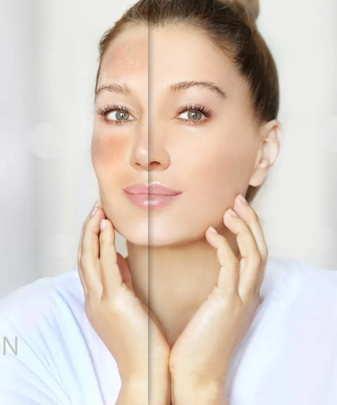 Face Treatments